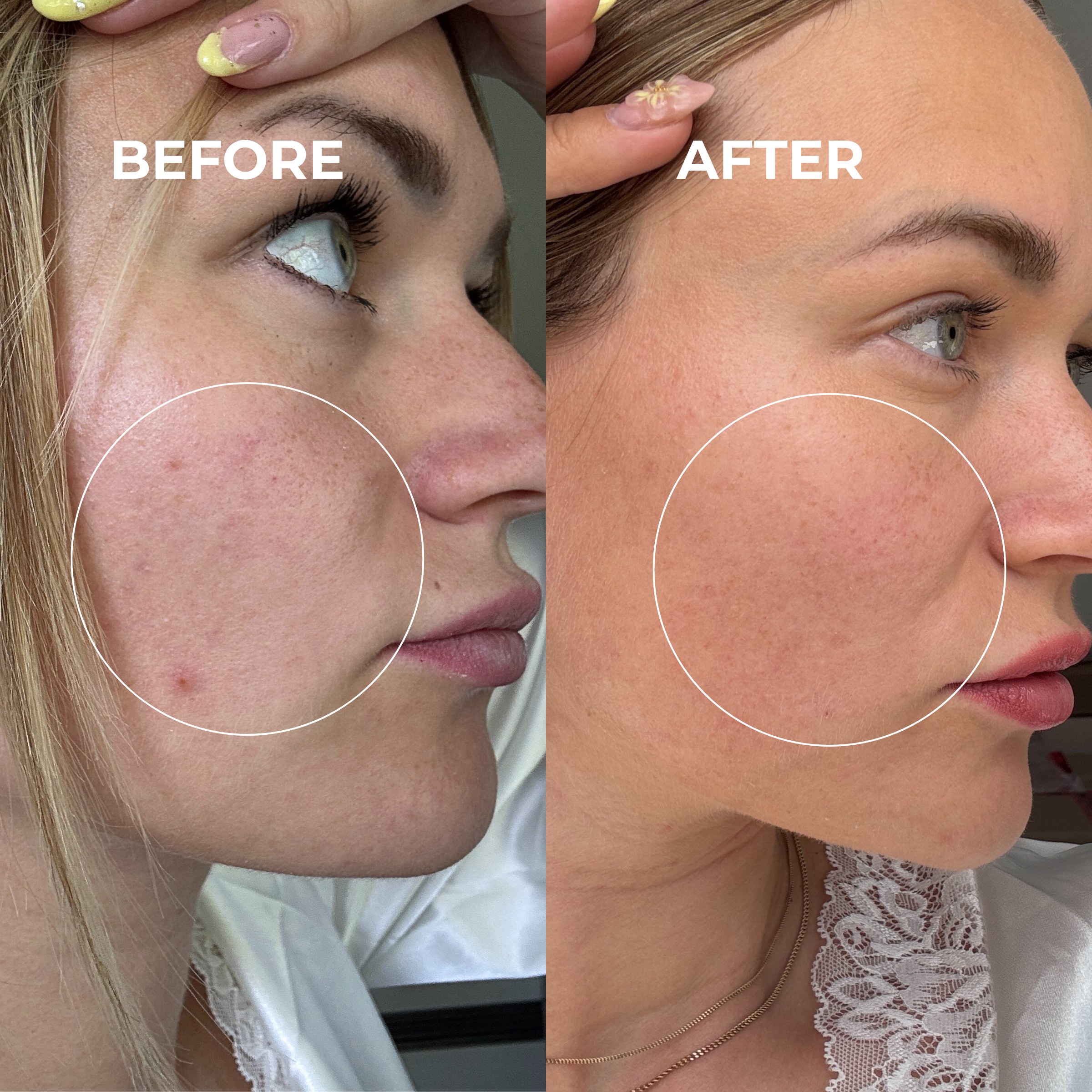 Niacinamide + 5-ALA Serum
