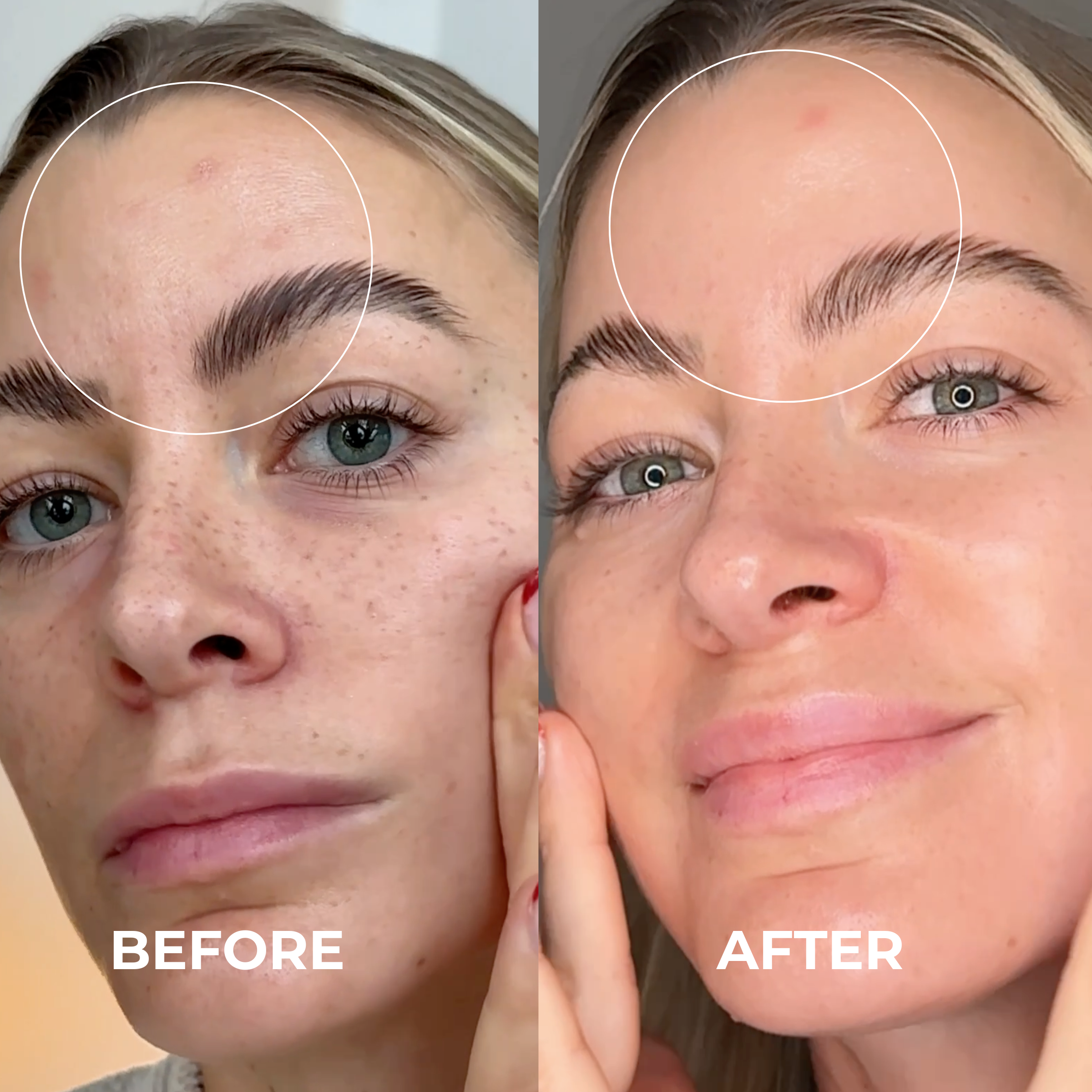 Niacinamide + 5-ALA Serum